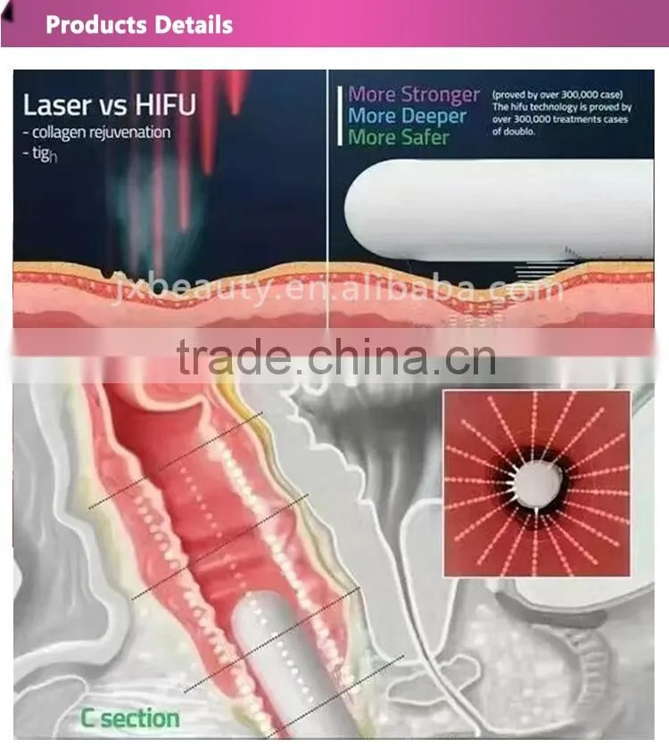 2016 Good effect 25mm focal length hifu vaginal tightening machine with CE certificate