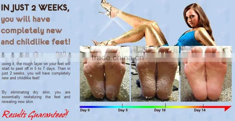 Foot dead skin remover peeling spa foot mask