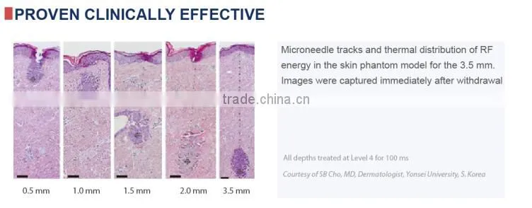 Most affordable and effective!!! Hot sale rf fractional microneedle / rf fractional micro needle / rf fractional