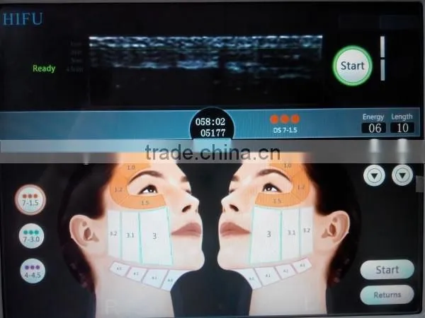 High Intensity Focus Ultrasound HIFU for Face and Neck Lift Without Surgery