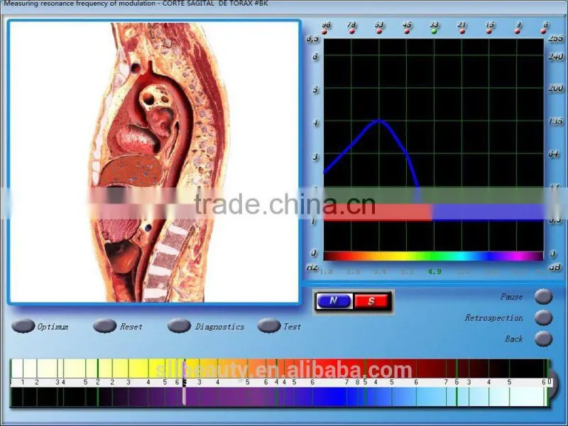 *2015*Original Hi-tech innovative human disease predictor machine
