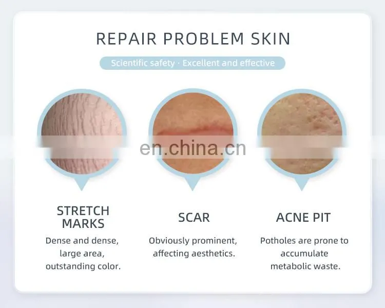 Medical Equipment CO2 Fractional Laser Vaginal Tightening Skin Resurfacing Acne Scar Removal Machine