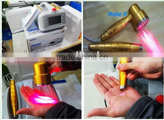 acupuncture press needles laser surgery equipment acupuncture needle