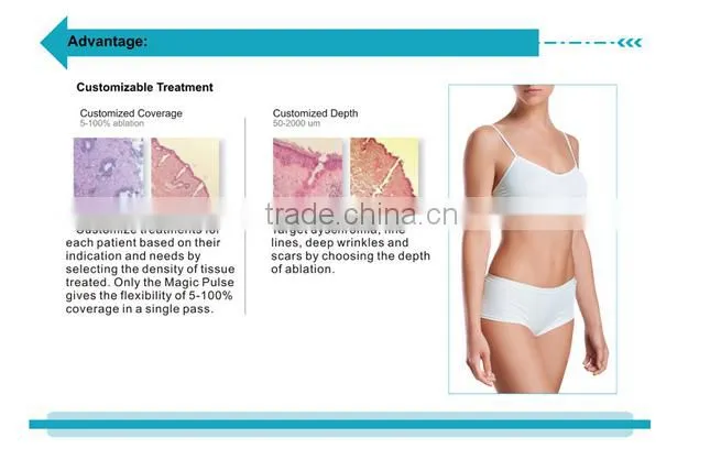 Big discount for High power RF tube CO2 fractional laser vaginal tightening skin resurfacing beauty machine--CV-I