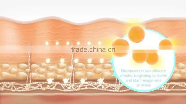 Guangzhou HETA Domestic Cryo lipo Laser Beauty Equipment face lifting