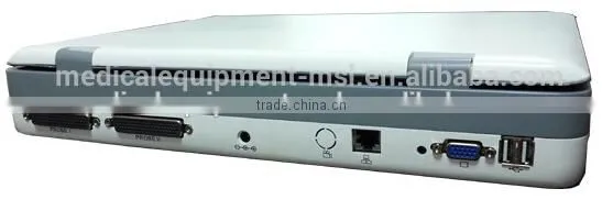 MSLPU25A HOT SALES Digital best Medical portable china portable ultrasound machine price