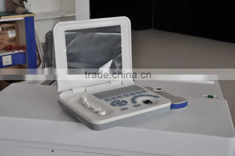 cheap Laptop Ultrasound scanner/ultrasonic equipments price 3018