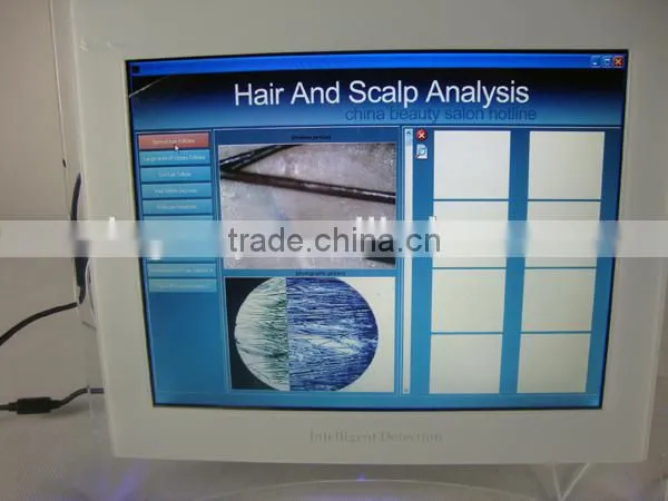 Degital Magic Mirror Hair Analysis Machine