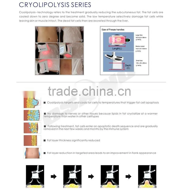 Portable Home Use Cold Laser Weight Loss Machine Aesthetic