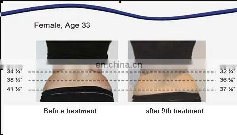 2019 Fashion best lipolaser 650 slimming machine 650nm lipo laser