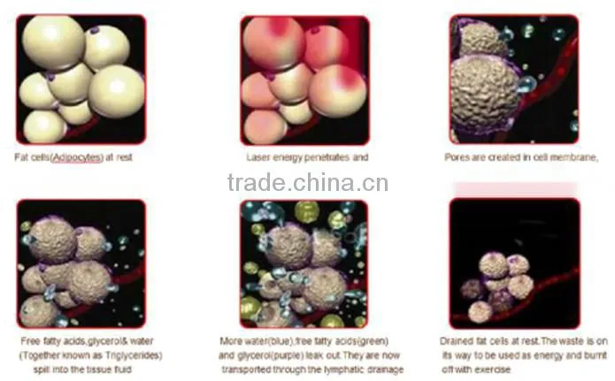 Skin treatment laser red blood vascular spot removal