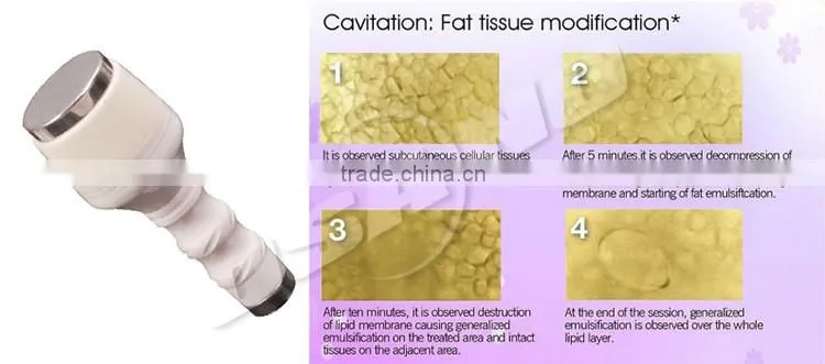 Body Vacuum For Slimming & Face Lifting Multipolar Vacuum RF For radiofrequency facial