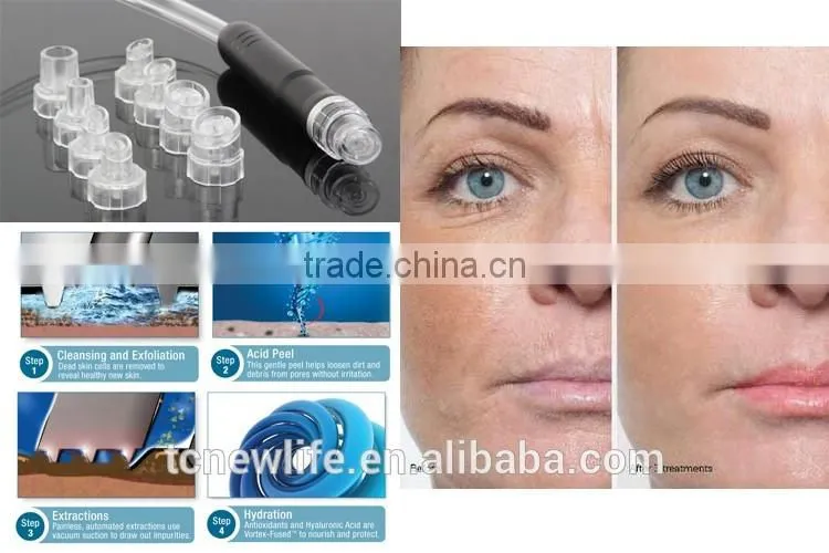 NL-SPA600 Multifunctional diamond microdermabrasion and oxygen machine