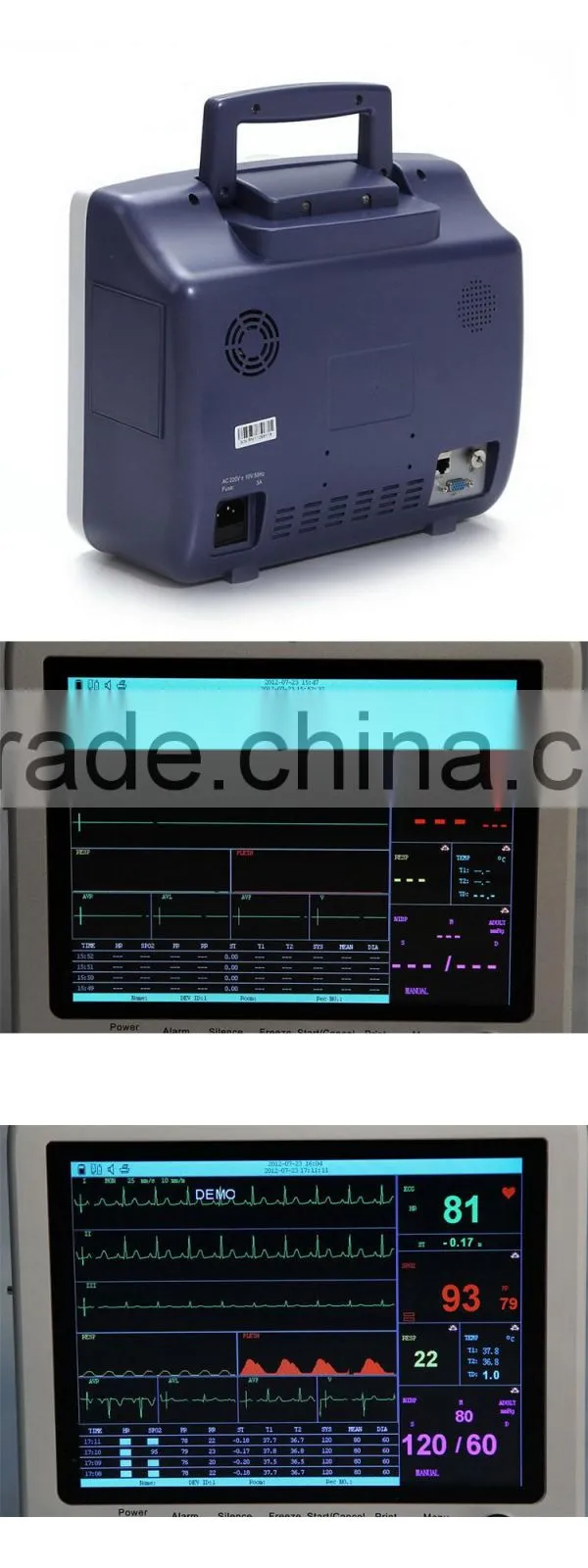 Hot product Ambulance 12 inch Multi Parameters ICU Patient Monitor applicable for hospital operation
