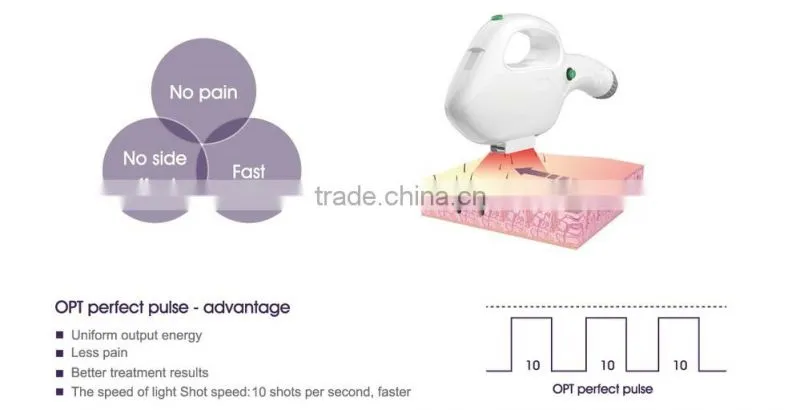 Hot selling Fashion handles ipl machine home use with CE certificate