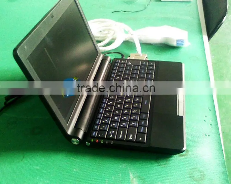 FN530 HOT selling full digital laptop ultrasound equipment