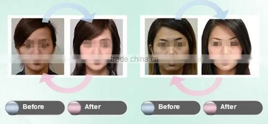 machine radio frequency facial led masks portable