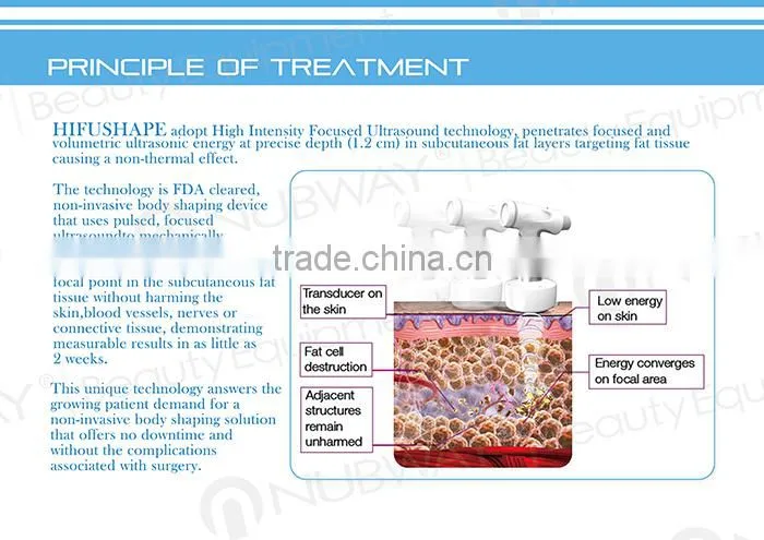 Hot Sales ! MIni Portable Home HIFU Liposuction Fat Reduction Ultrasound Machines