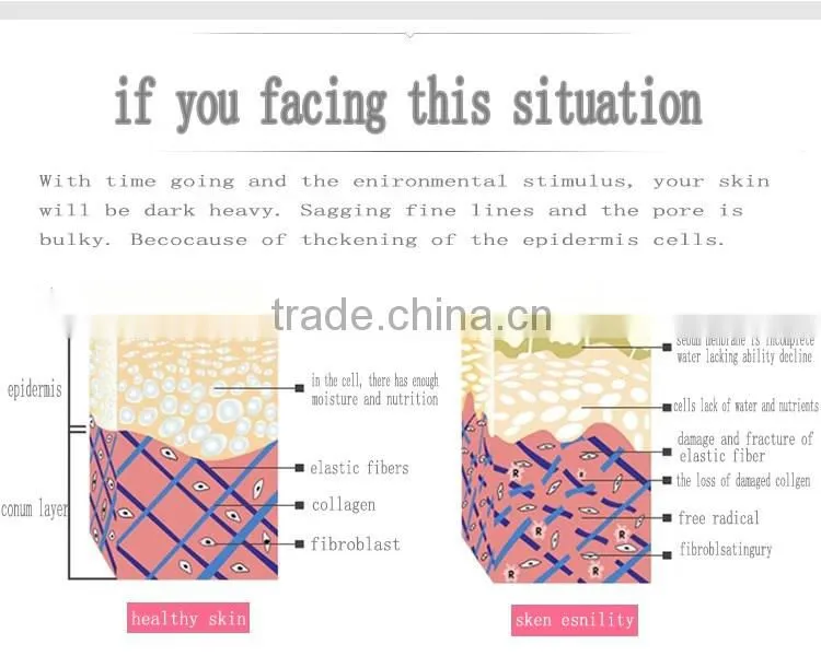 Wholesle New Product Beauty Tools Facial Skin Care 3 In 1 Ultrasonic Microdermabrasion Machine