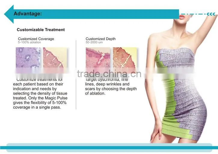 portable RF drive fractional freckle wrinkle acne scar removal whiting CO2 fractional laser machine -CV-II