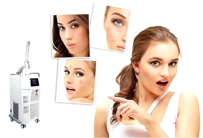 Facial Skin Whitening Vaginal Tightening 10600nm RF Co2 Laser Carbon Laser for Skin Fractional Co2 Laser