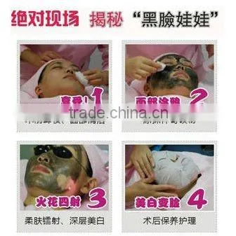 Q-switched Nd:YAG Laser for toenail fungus