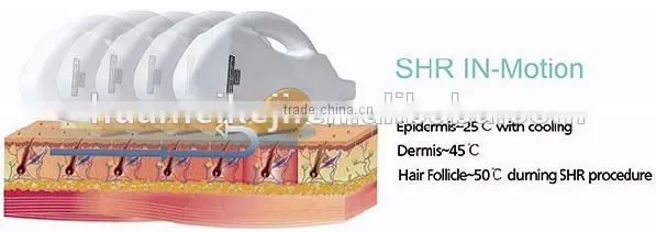 OPT beauty salon equipment ipl shr laser/ipl shr hair removal machine