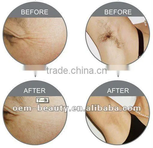 2012 Best IPL beauty machine for skin tightening and hair removal