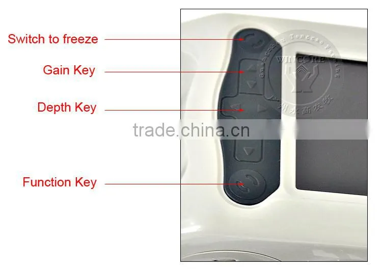 Waterproof ultrasound scanner for veterinary ultrasonography B ultrasound