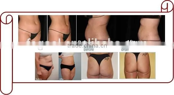 2015 Fat Cavitation Slimming beauty Equipment Ultrasound Cavitation Slimming beauty Machine on sale
