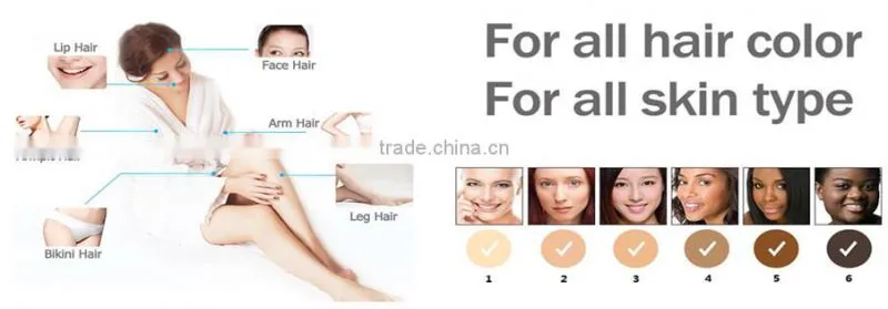 Nice design Laser machine 808nm diode laser hair removal machine
