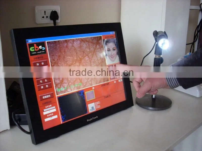 hot-selling made in Taiwan smart system digital dermatoscope portable skin analysis