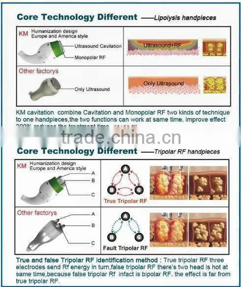 (CE ISO TUV SGS approved) 2014 best rf cavitation body slimming machine