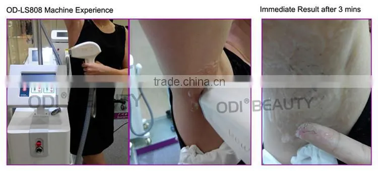 Wholsale 808nm Diode Laser hair removal machines OD-LS808