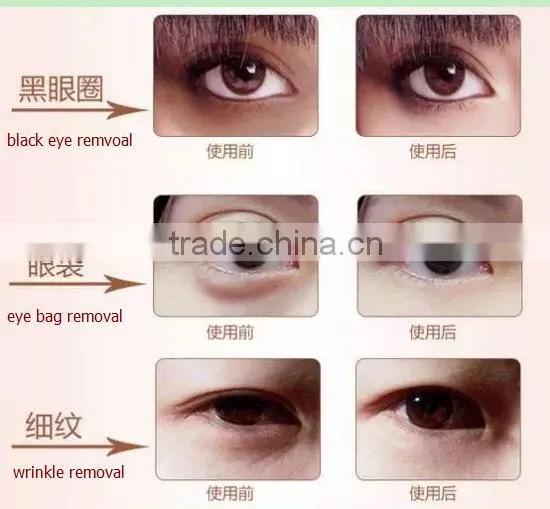 Portable eye massage rf lifting beauty machine for home use