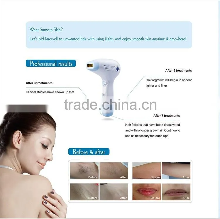 CE RoHS PSE REACH approved home use IPL beauty device with permanent results
