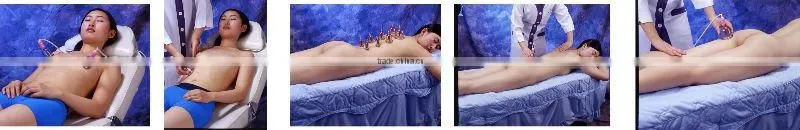 Physical therapy breast augmentation machine vacuum nipple sucking breast augmentation cupping machine