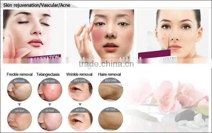 IPL Hair Removal Skin Rejuvenation Vascular&Acne Removal Beauty Salon Equipment&Machine