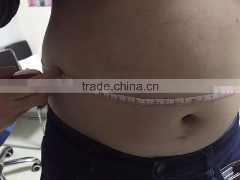 High quality hifu machine coming/ Hifu machine for slimming and skin care