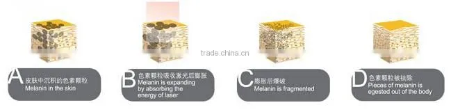 SQ-3 Q Best selling products portable nd yag remove tattoo laser/ home laser skin tightening/ at home skin tightening machine