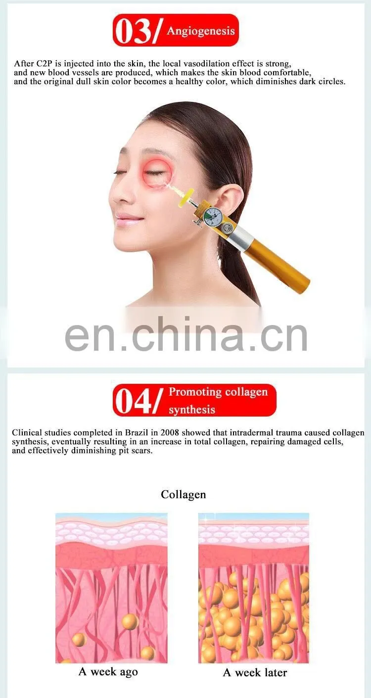 Factory CDT micro plastic equipment /CO2 therapy solution carboxytherapy for dark circle wrinkles scars