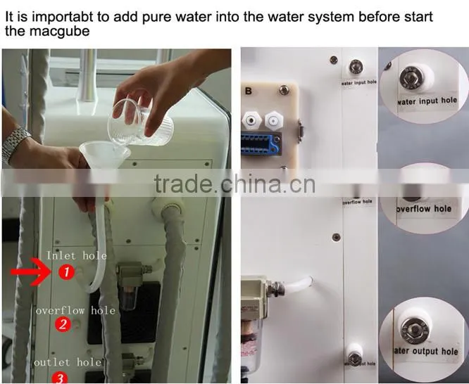 2015 Cryolipolysis Portable 4 handpiece Cryolipolysis Cryo fat freezing machin