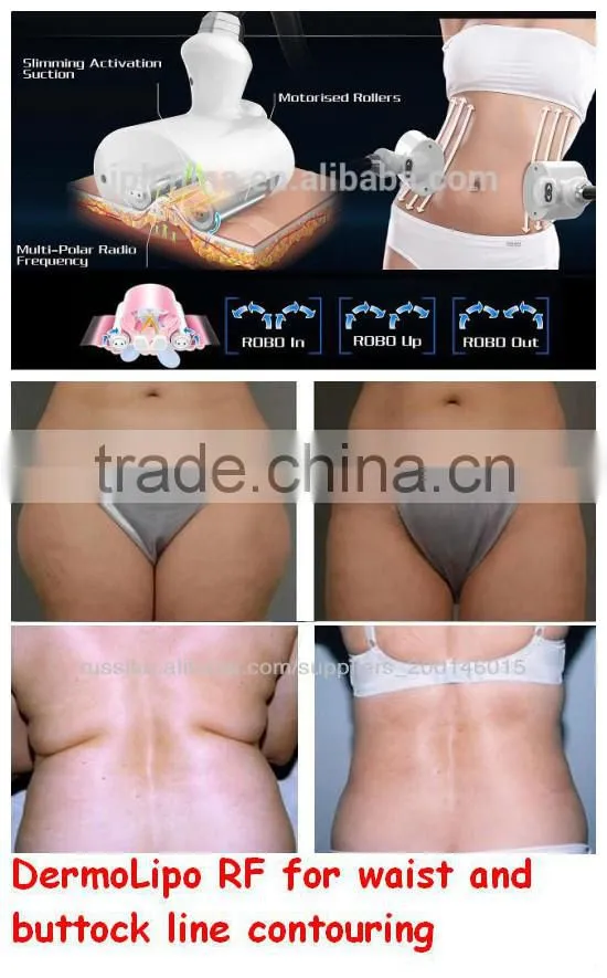 2015 Radio Frequency Rolling Guangzhou beauty FSWT machine Wholesaler