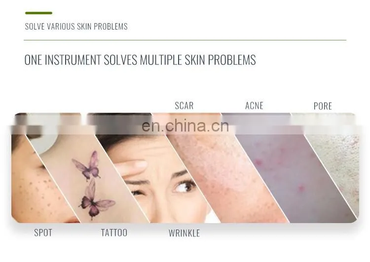 Professional Brown Style Pico Laser Tattoo Removal Solon Beauty Machine