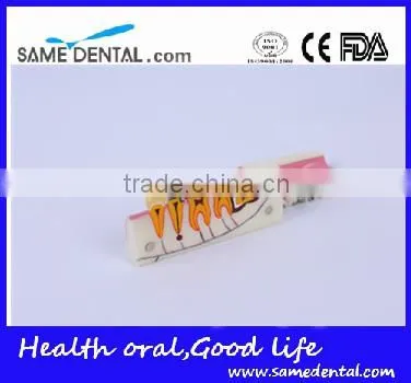 Right Tooth Tissue Decomposition Model Dental Eduction Assitant No. DEA-17