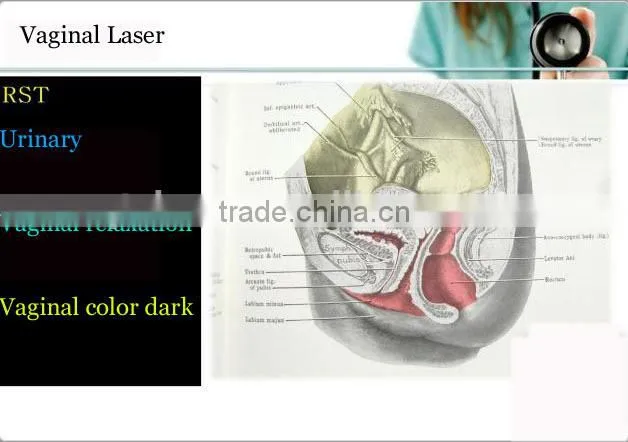 co2 fractional laser 60w RF tube /fractional co2 laser acne scar removal