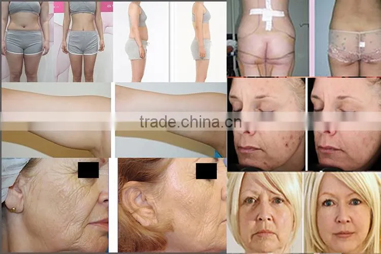 slim face machine slimming beauty equipment best quality product