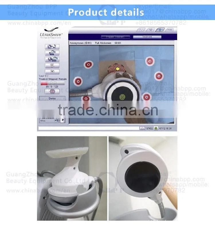 HIFU ultrashape best new slimming technology machine