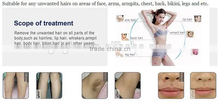 GLM E-016 808NM laser hair removal machine/ life span 20,000,000 shots