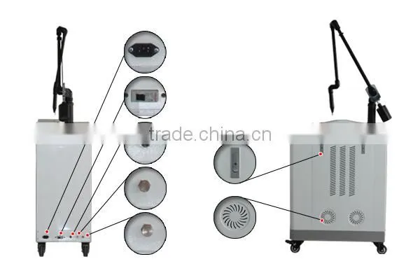 2016 high quality factory price q switch nd yag laser tattoo removal machine